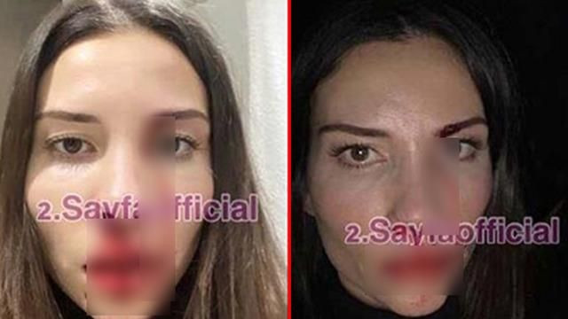 Futbolcu Özer Hurmacı eşini darp etti: Saldırı sonrası fotoğrafını paylaştı