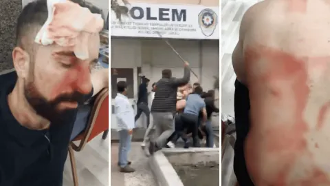 Ankara Adalet Sarayı şantiyesinde taşeron firma yetkililerinin işçilere saldırması sonucu yaralanan işçilerin durumu