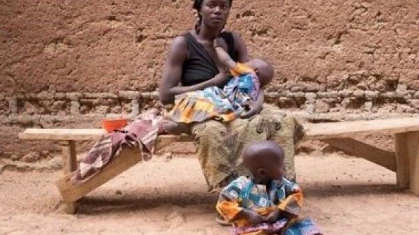 afrika da 58 bucuk milyon cocuk kronik beslenme yetersizligi icinde sol haber
