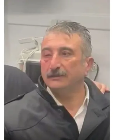 bursa